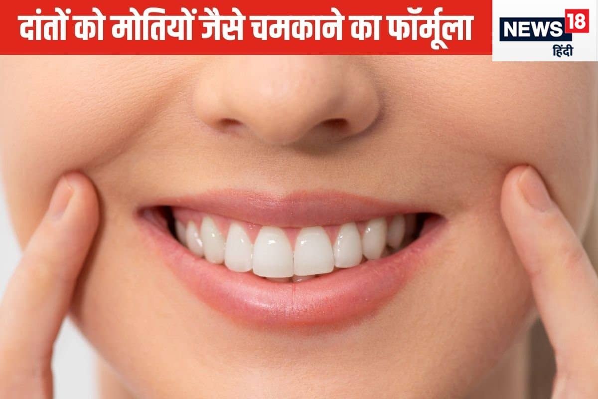 Teeth whitening by baking soda 2024 07 7f70c54bd5d24cb264bb6effd6b51da4 3x2 55ize3