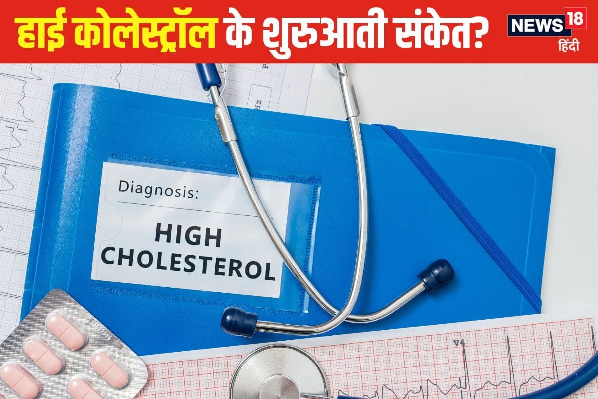 cholesterol 8 2024 08 01d5e8955c94cd6b976259a43f9d7b0f 3x2 ILV7tv