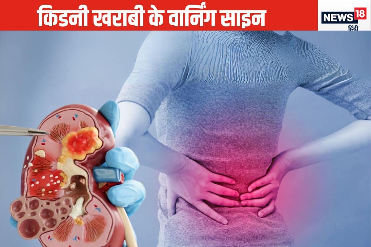 Early sign of kidney problem 2024 10 1658941d7eea0d37ffeb873f5ac4179f 3x2 tqoc9U