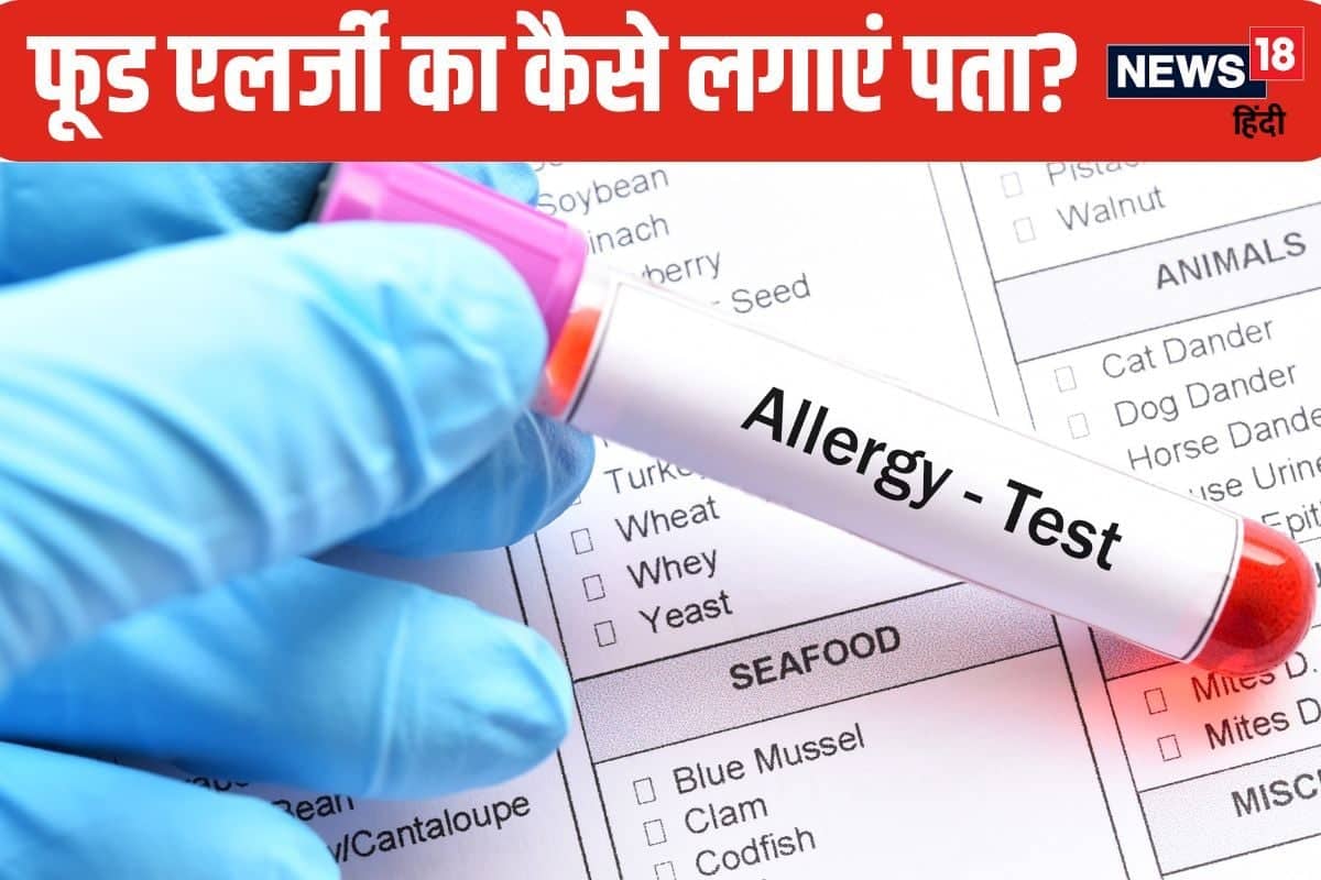 food allergy tests 2024 10 0953dd494c428672813f77424c1c2c05 3x2 5WjnhF